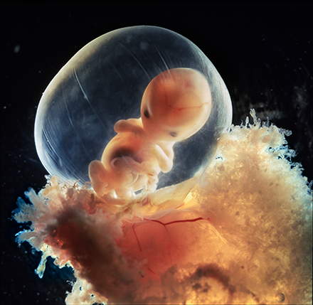 fetus at 10 weeks gestation in amniotic sack; key body parts and organs are present