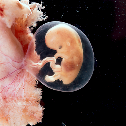 fetus at 12 weeks gestation in amniotic sack; skin is starting to cover the body