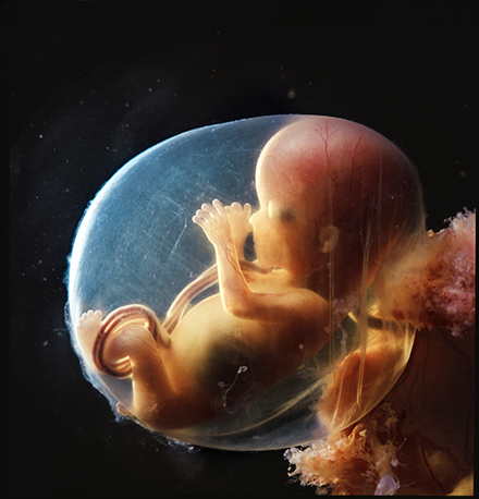 fetus in amniotic sack at sixteen weeks gestation