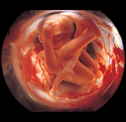 a fetus at 26 weeks gestation curled up in the amniotic sack