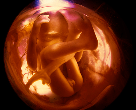 a fetus at 34 weeks gestation in the amniotic sack