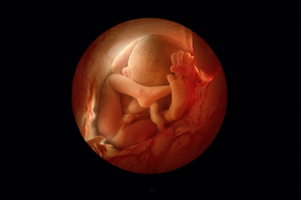 a fetus at 36 weeks gestation curled up inside the amniotic sack