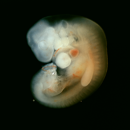 embryo at six weeks gestation